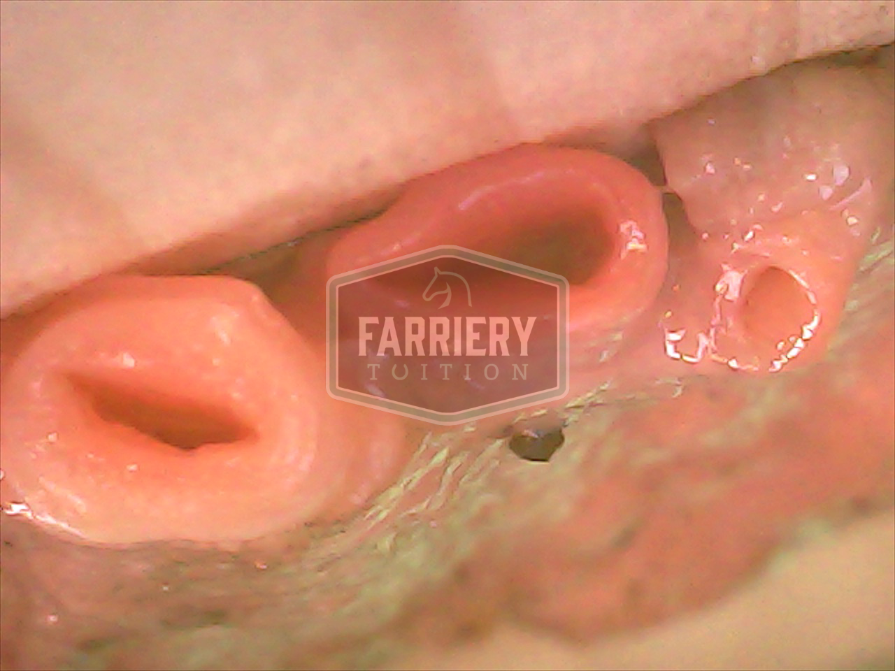 Neurovascular bundle2 with watermark.jpg